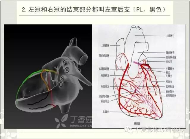图文详解冠脉解剖及分段
