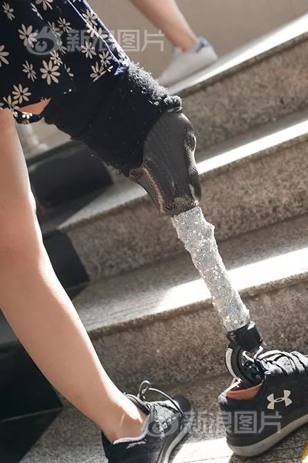 周末故事自信女孩卸下伪装露出假肢没有腿照样可以穿短裤