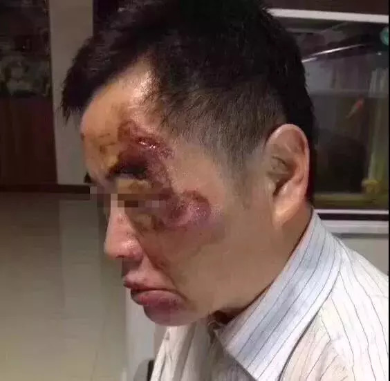 "昆山砍人案"为何被认定为正当防卫?
