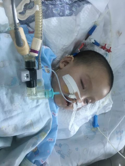 2岁萌童误食氢氧化钠导致中毒 究竟是孩子的顽皮还是家长的疏忽