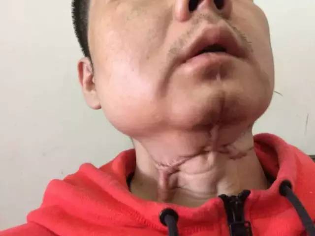 千亿"软性毒品"槟榔,和正在上瘾的6000万中国人