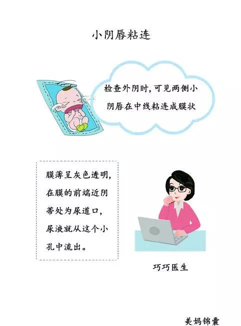 小阴唇粘连|宝宝|护理_新浪网