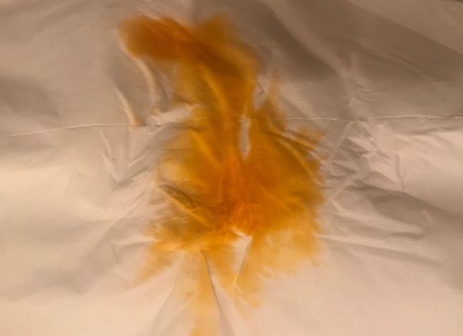 油鱼|屁股|菊花_新浪新闻