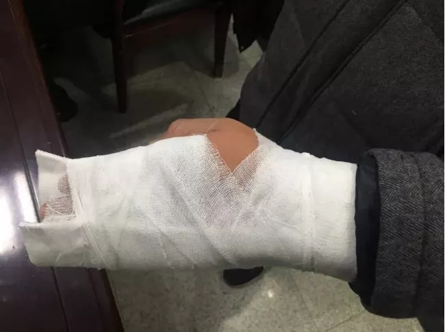 江苏一男子醉驾,撞车,还掰断警察手指:涉嫌妨害公务被刑拘