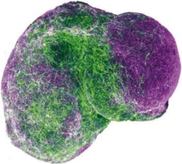干细胞衍生的3D人脑组合图。