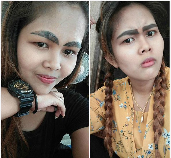 泰女子纹眉失败留下黑粗浓眉做激光清除手术