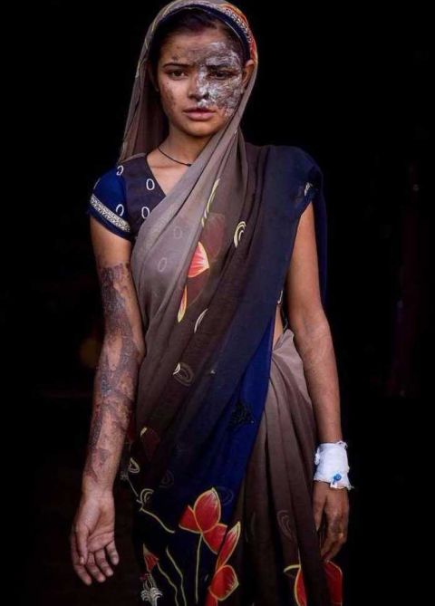 妹妹被卖老男人,大女儿发现父亲的秘密,竟被父亲泼硫酸毁容!