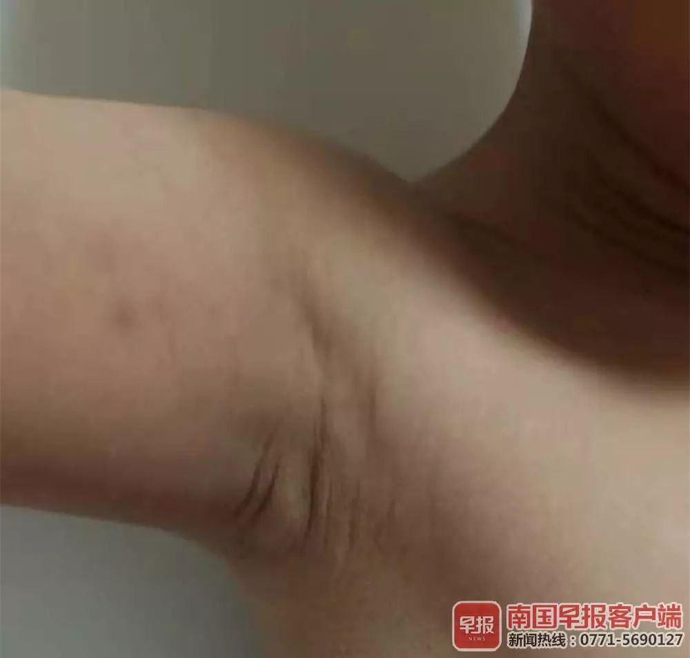 男孩不睡午觉被殴打40分钟 午托中心:临时工干