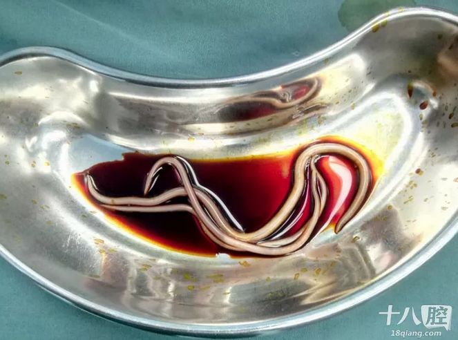 蛔虫又称似蚓蛔线虫,寄生在人体肠道内,依靠汲取人体体内的营养存活