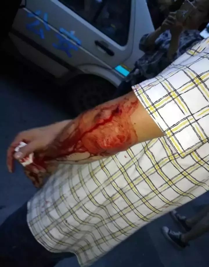 业主被打到头破血流,事发原因系物业与业主纠纷