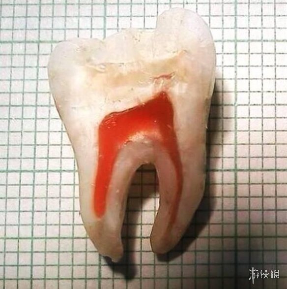 牙釉质切片图图片