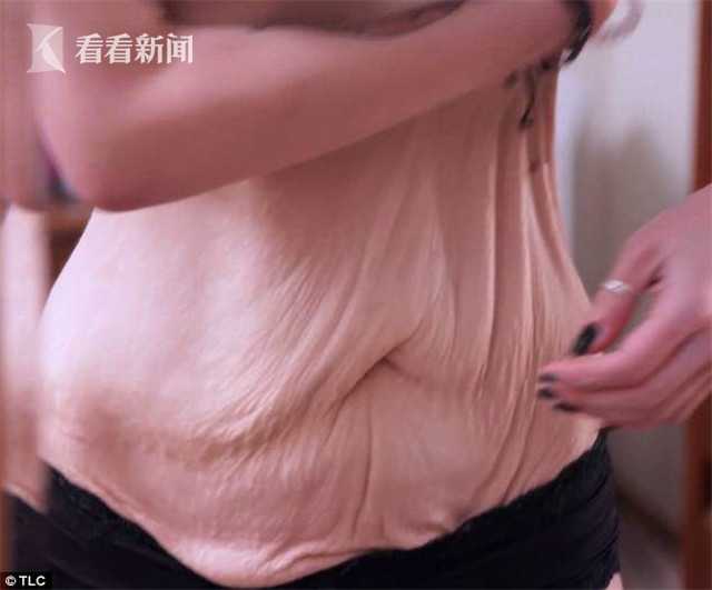 女子痴迷减肥脸确实美了但脱下衣服自己都害怕