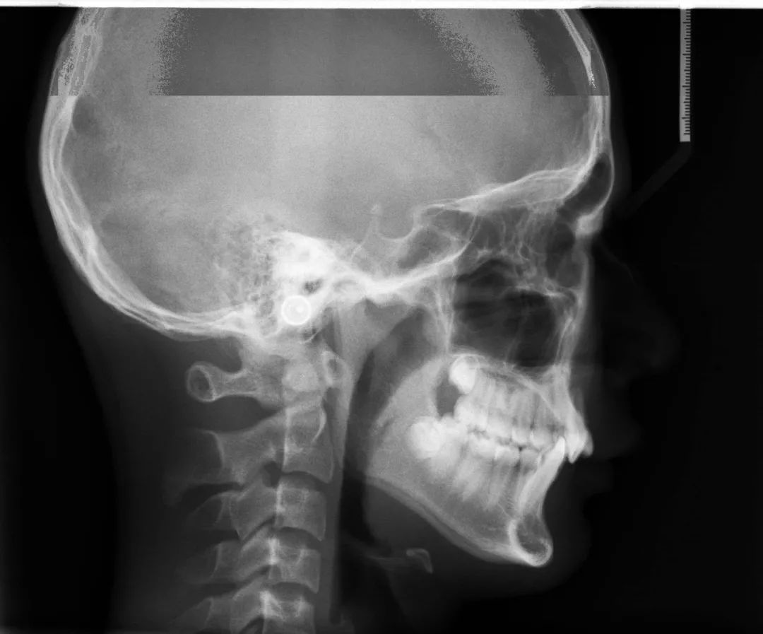 张天爱这个部位凸起