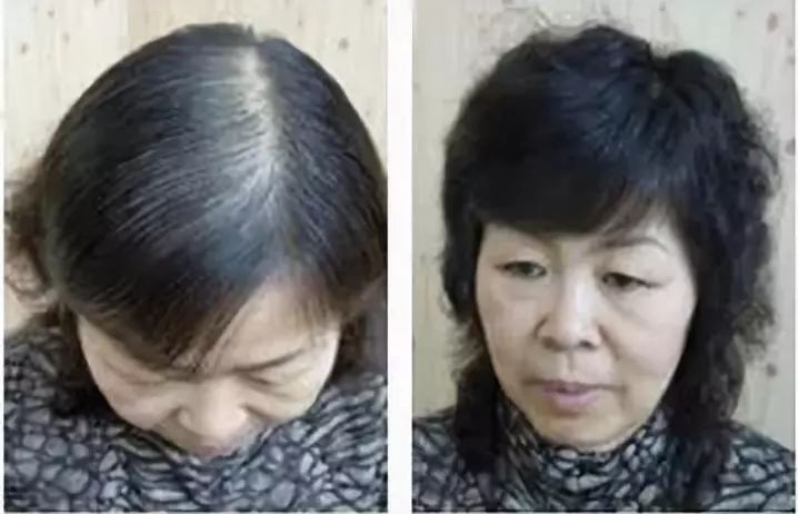 只要洗一洗,白发变黑发!从此远离化学染发|黑发乳|黑发|丽彩_新浪新闻
