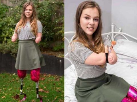 她7岁失去四肢, 如今乐观面对生活