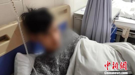 眼睛被烧伤的吴江(化名)在批准治疗。长沙市中间医院供图