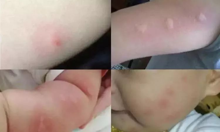 哪种驱蚊剂最安全,家有宝宝的要谨慎挑了|蚊子|驱蚊液|驱蚊_新浪育儿