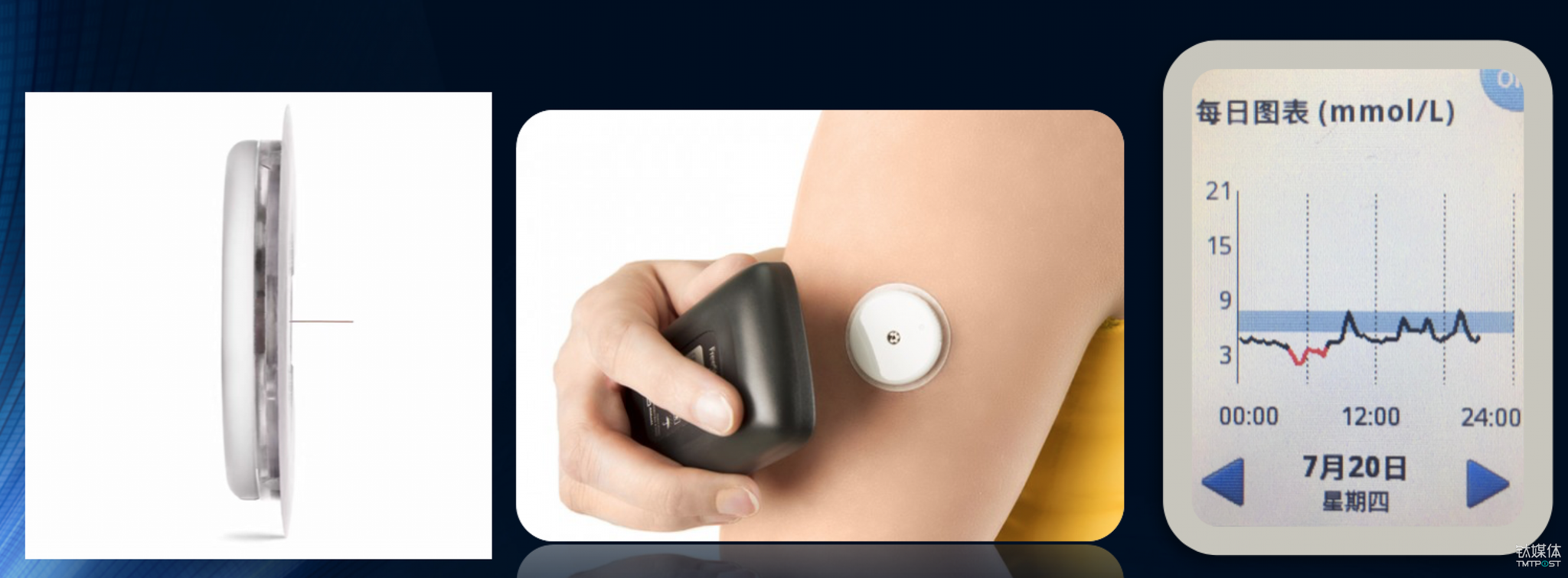 图为雅培辅理善瞬感系统,从左到右依次为传感器,血糖扫描仪,数据显示
