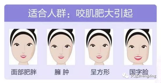 东方审美观追求柔和的线条,所以过于发达的咀嚼肌造成下面部轮廓外张