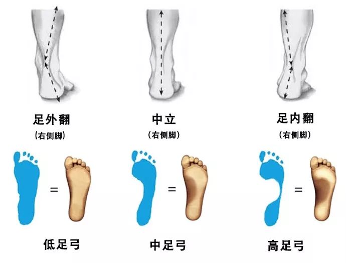 下面8种疼痛信号出现时 你可能已经把自己跑伤了 手机新浪网 下面8种疼痛信号出现时 你可能已经把自己跑伤了 手机新浪网