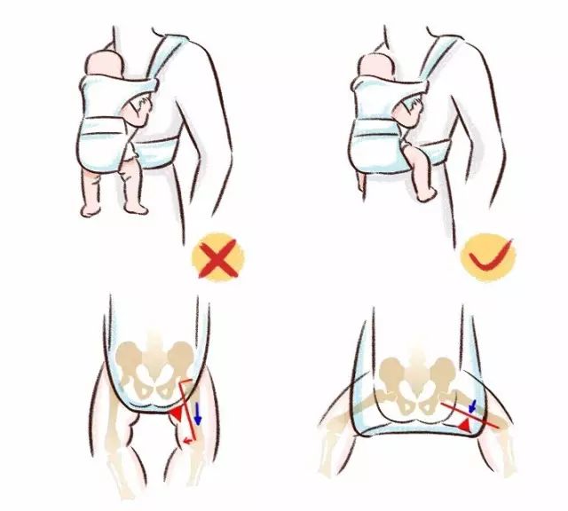 宝宝学步脚尖走路o型腿内八字正常吗
