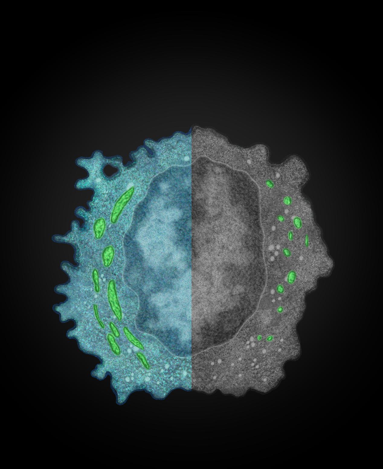 中国科大发现肝脏肿瘤逃脱自然杀伤细胞免疫监视的新机制 手机新浪网