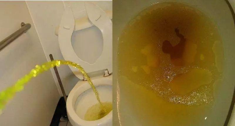 【警惕】80岁老伯洁身自好多年,竟然被查出严重梅毒!