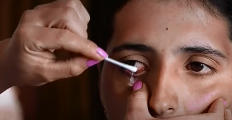 亚美尼亚女子眼睛流出钻石眼泪画面曝光图