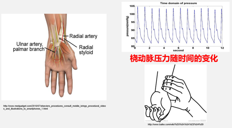 探索脉搏波的临床诊疗价值,「金姆健康」先从女性健康开始进行商业化