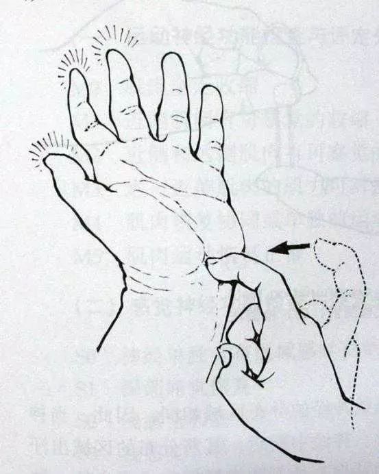 脑出血的信号千万别等半身不遂才看到