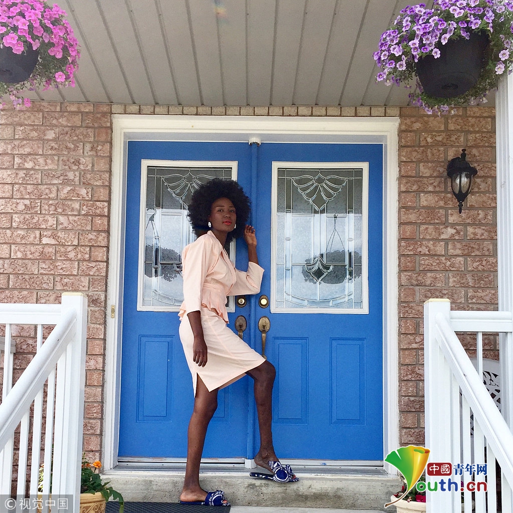 海地女孩因"腿丑"备受嘲讽 后成模特勇敢追梦