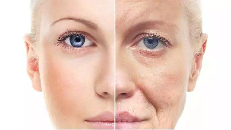 哪些人不适合注射肉毒素|科思特|肉毒素|咬肌_新浪女性_新浪网