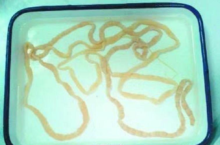 绦虫|长虫|牛肉_新浪新闻