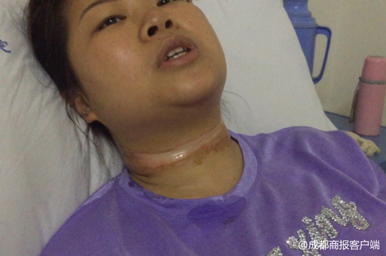 成都女子骑电动车经过正捆扎货物货车时 被绳子勒伤脖子