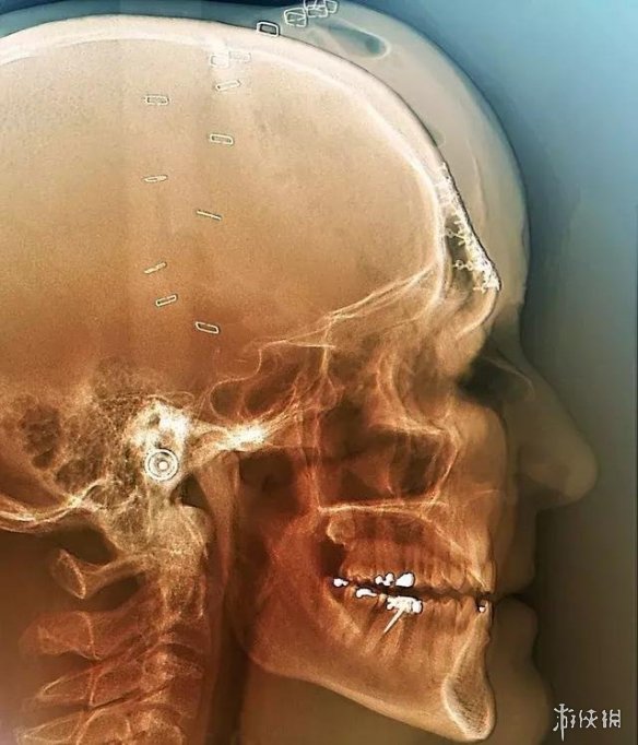 x光照片中的人类身体长啥样感受人体的奥妙之处