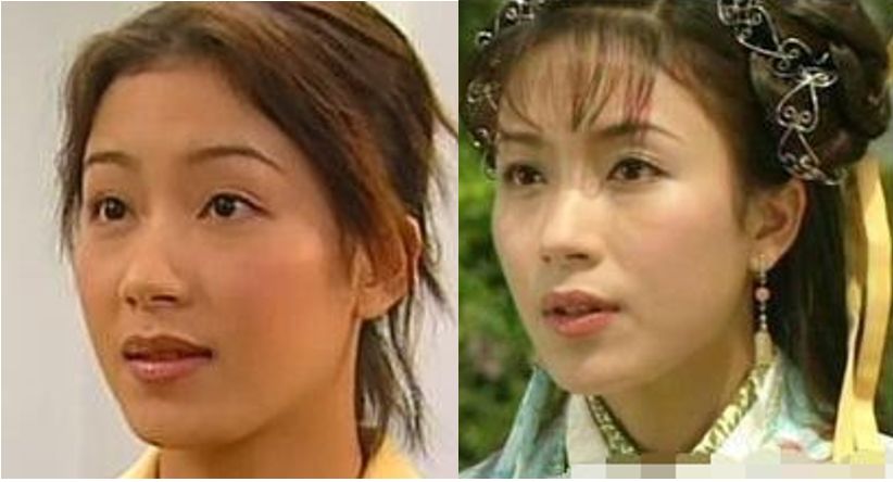 这位实力派女演员的新假体比木棍还粗|杨怡|假体|鼻子_新浪女性_新浪