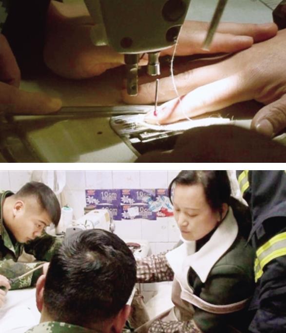 女工做窗帘手指被缝纫机针刺穿 救援中全程淡定脸