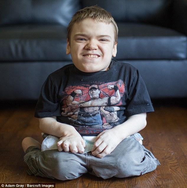 美国夫妻中等身高但4个孩子中3个患侏儒症