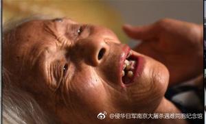 病卧在床的顾秀兰。图片来源:侵华日军南京大屠杀遇难同胞纪念馆官方微博 。