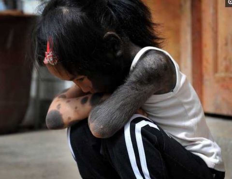 中国毛孩 2岁遭妈妈抛弃 幸亏好心人收养 全身布满绒毛和黑点