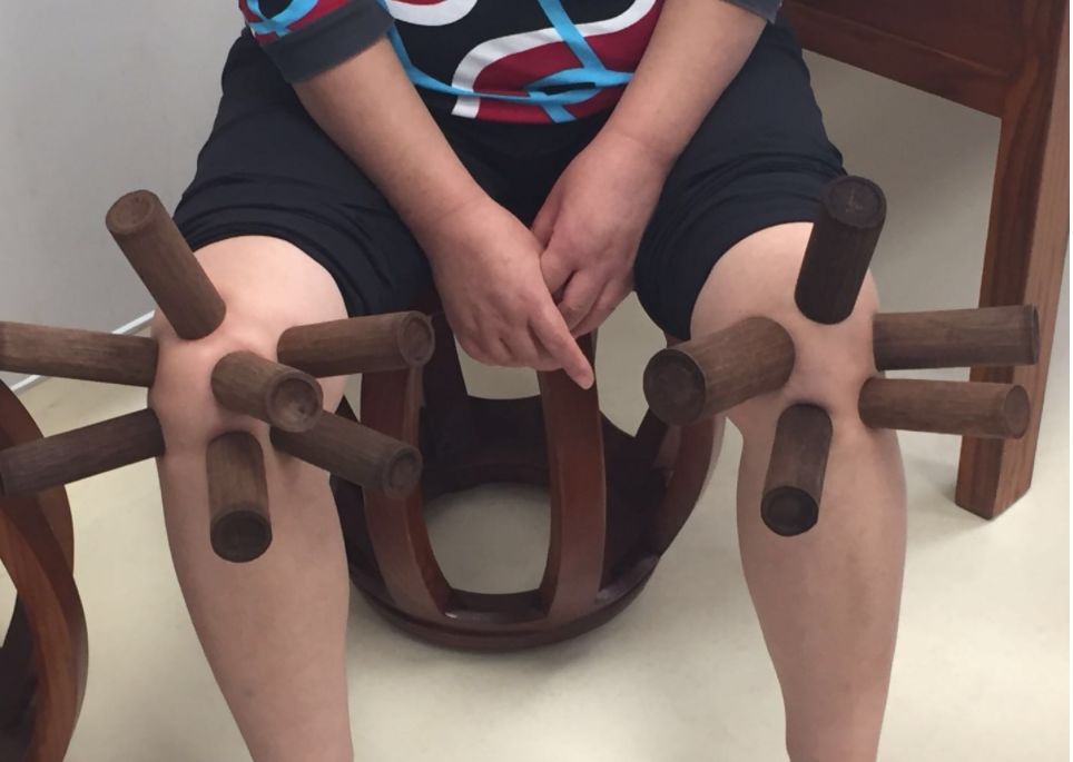 《广西记忆 听见非遗》| 壮医药物竹罐疗法