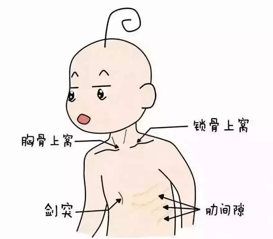 孩子是肺炎还是感冒看这3点最靠谱