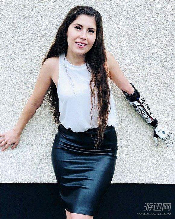 断臂女孩cos《守望先锋》麦克雷 机械义肢助力演员梦