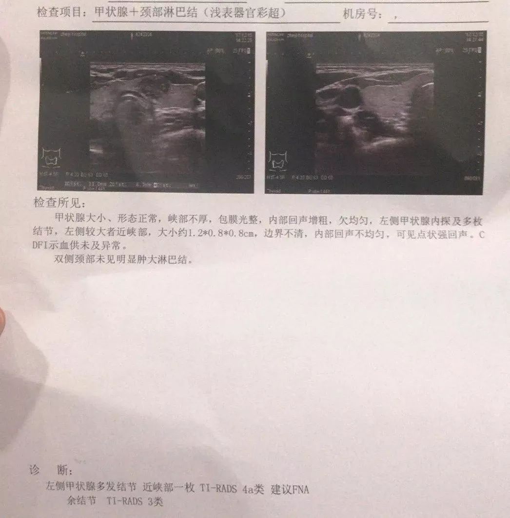 体检查出癌症!31岁女白领:我是工作狂,天天宵夜减压,以后不要太拼了