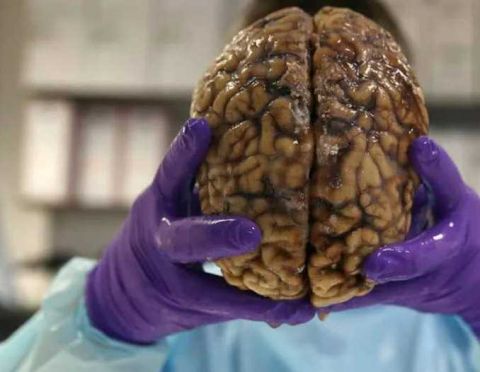 世界上最恐怖的银行专门储存人类大脑每年不少人排队存大脑
