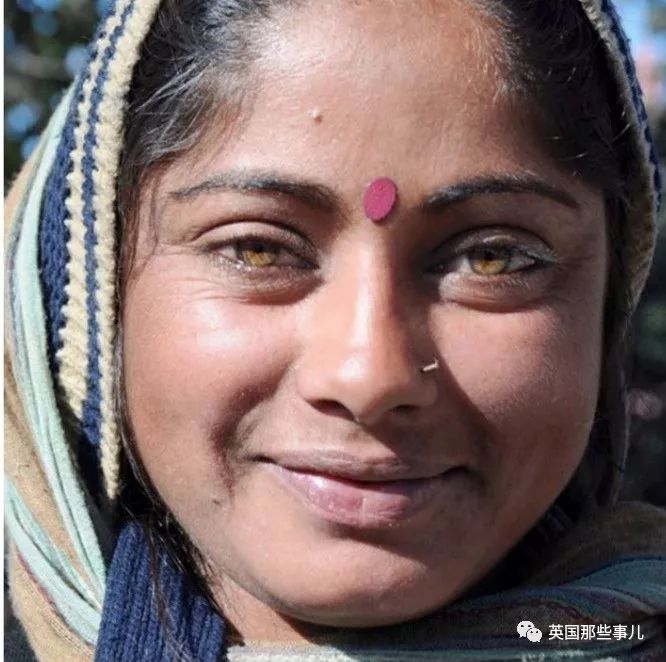 琥珀色眼睛根据深浅不同,从金黄色到黄铜色均有呈现.