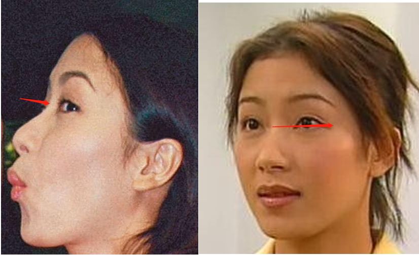 这位实力派女演员的新假体比木棍还粗|杨怡|假体|鼻子_新浪女性_新浪