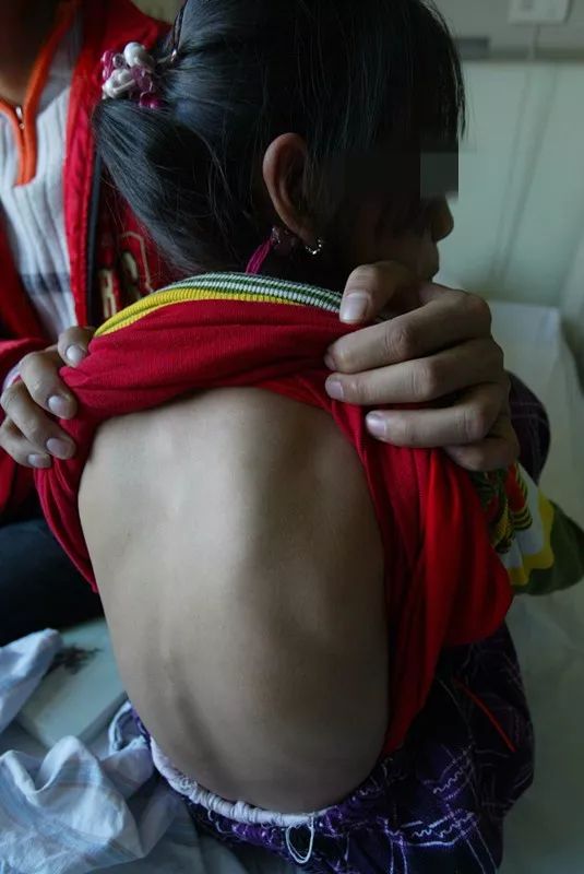 暑假很多人一窝蜂看这病,再晚要吃大苦头