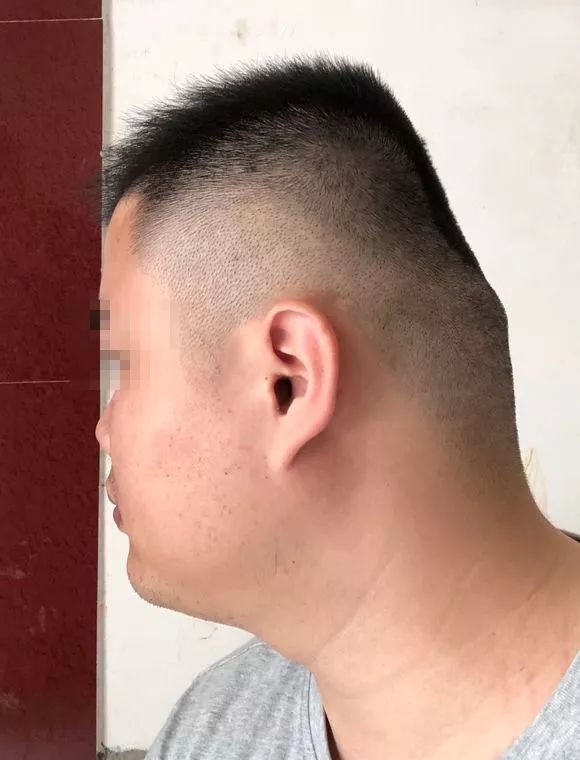 圆头|后脑勺|脑袋_新浪新闻