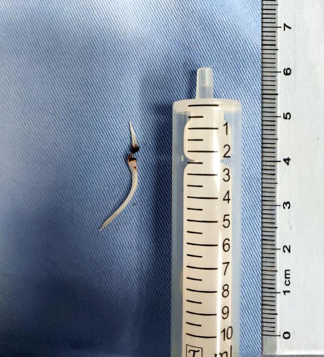 鱼刺卡喉求千万不要试图用饭团、馒头把鱼刺吞进去休闲区蓝鸢梦想 - Www.slyday.coM